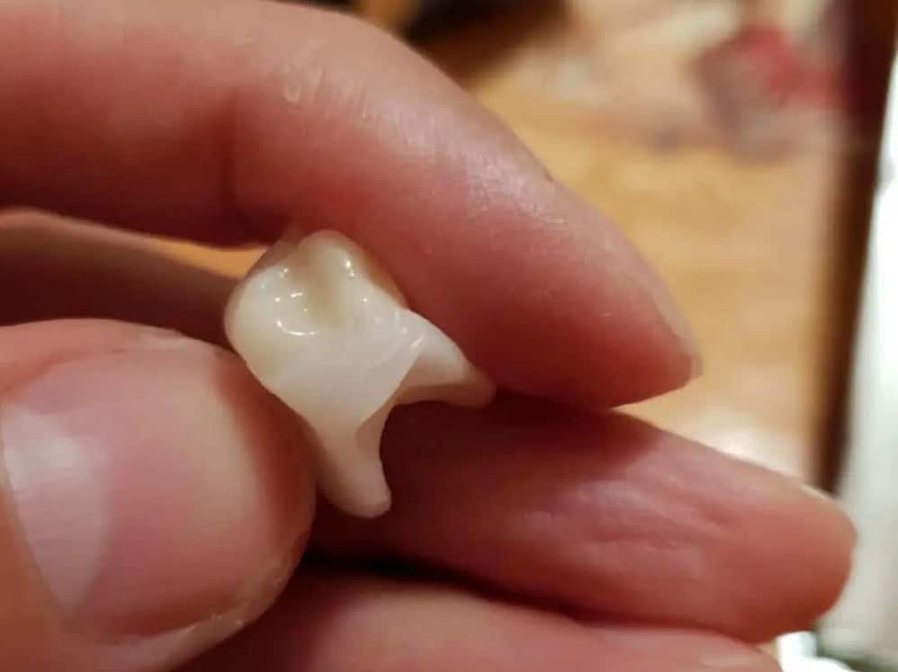 Detail korunky a tvarování materiálu Denticor
