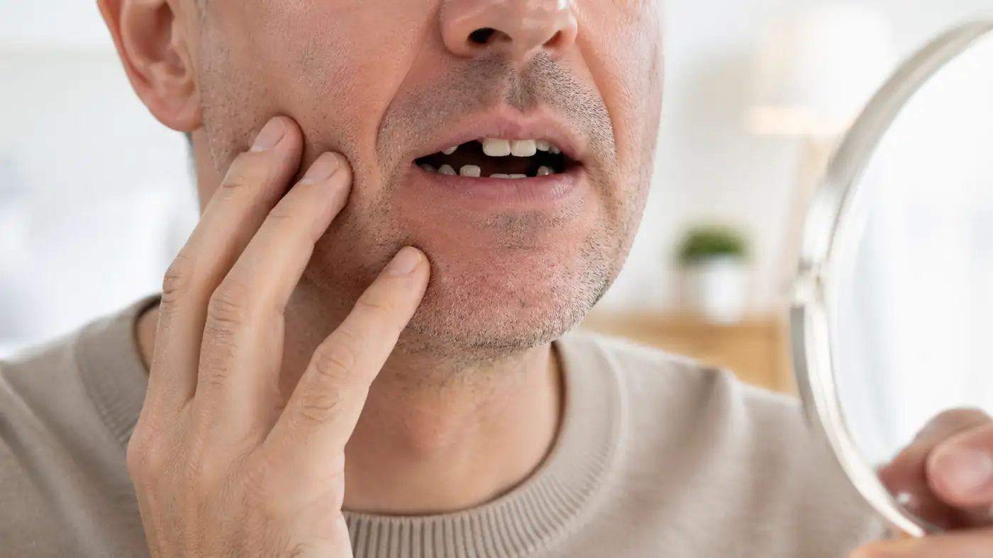 Více chybějících zubů — nejprve je třeba zmapovat, které mezery jsou vhodné