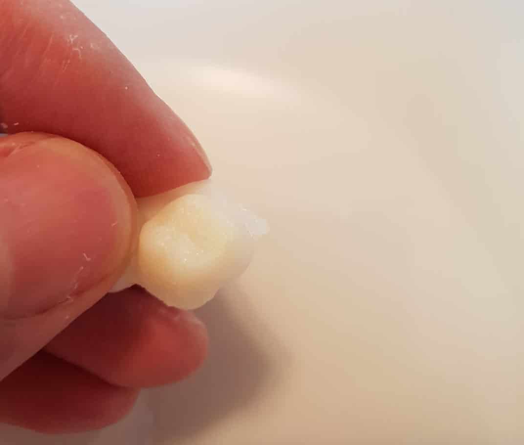 Prvý prototyp zubní náhrady Denticor