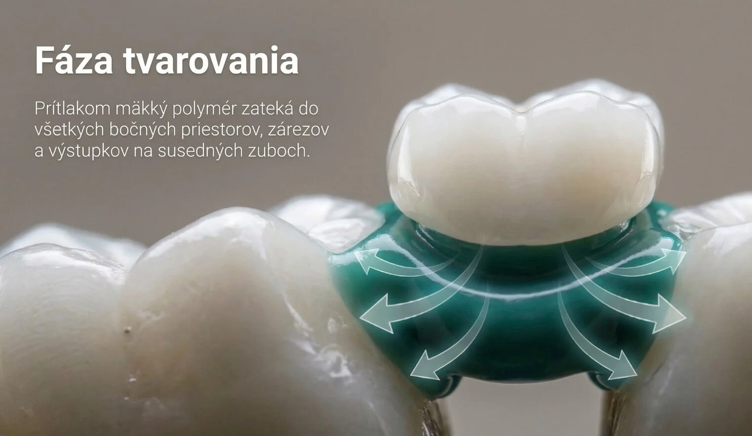Fáze tvarování mechanického zámku Denticor