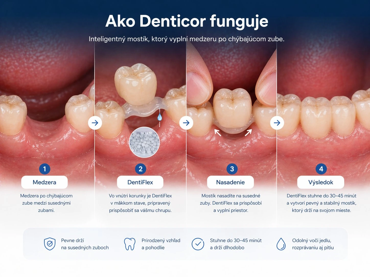 Jak Denticor funguje — inteligentný můstek, který vyplní mezeru po chybějícím zube. Štyri kroky: mezera, DentiFlex, nasazení, výsledek. Pevne drží, prirodzený vzhled, ztuhne do 30 až 45 minut, odolný vůči jedlu, mluvení i pitiu.
