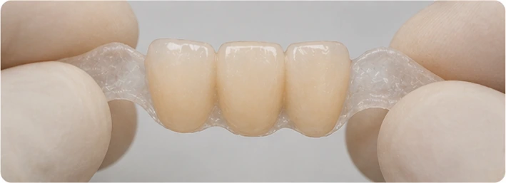 Vizuální návod — chybějící horní oční zub a premolár