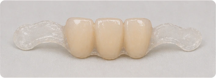 Hotová náhrada mimo úst