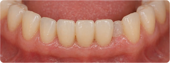 Výsledek po usadení