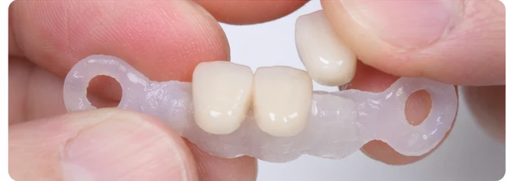 Vizuální návod — chybějící tři přední horní zuby