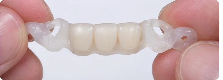 Vizuální návod — chybějící tři přední horní zuby