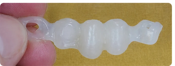 Vizuální postup pro dva premoláre a stoličku hore — princip vloženia Denticor můstku s novými zuby a jeho dotvarovania o okolní zuby