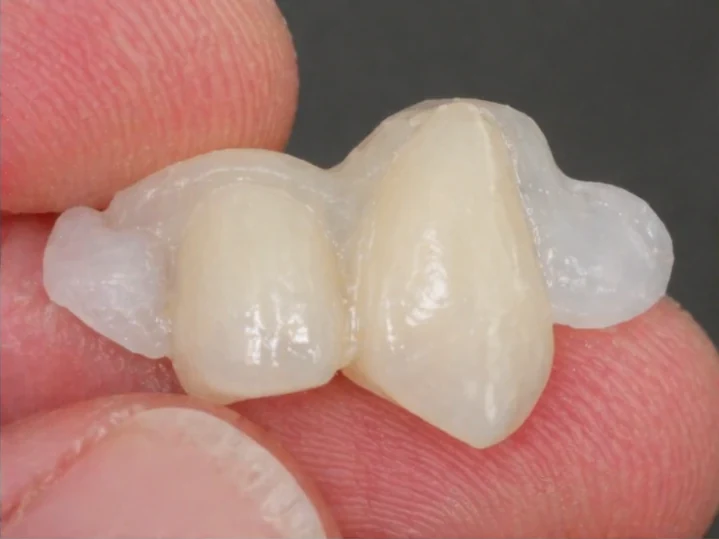 Vizuální návod — chybějící dolní rezák a oční zub