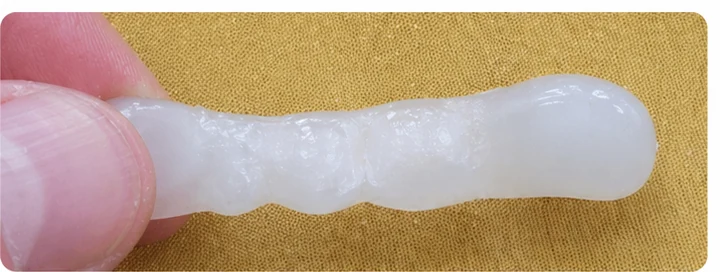 Vizuální postup pro oční zub a dva premoláre hore — princip vloženia Denticor můstku s novými zuby a jeho dotvarovania o okolní zuby