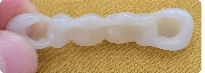 Vizuální postup pro oční zub a dva premoláre hore — princip vloženia Denticor můstku s novými zuby a jeho dotvarovania o okolní zuby