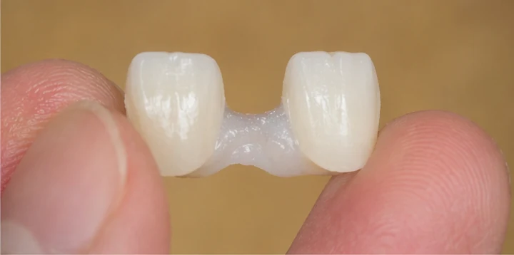 Vizuální postup vloženia a dotvarovania náhrady — dolní rezák a oční zub