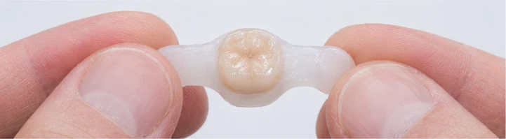 Vizuální návod — chybějící dolní premolár