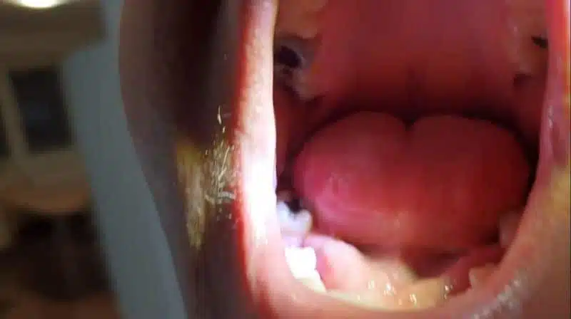 Zákazníčka — chybějící boční zub